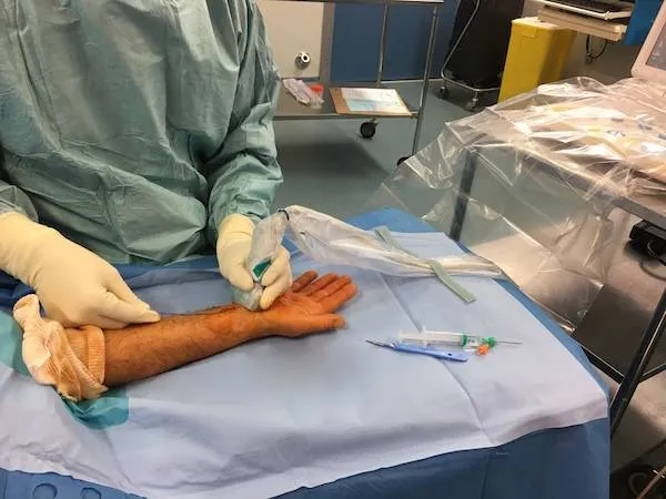 Le nouveau traitement du canal carpien: chirurgie guidée sous échographie canal carpien nouveau traitement : chirurgie guidée sous échographie